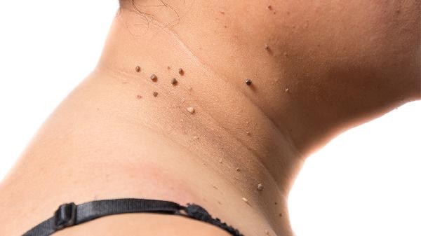 化妆皮肤怎么日常保养