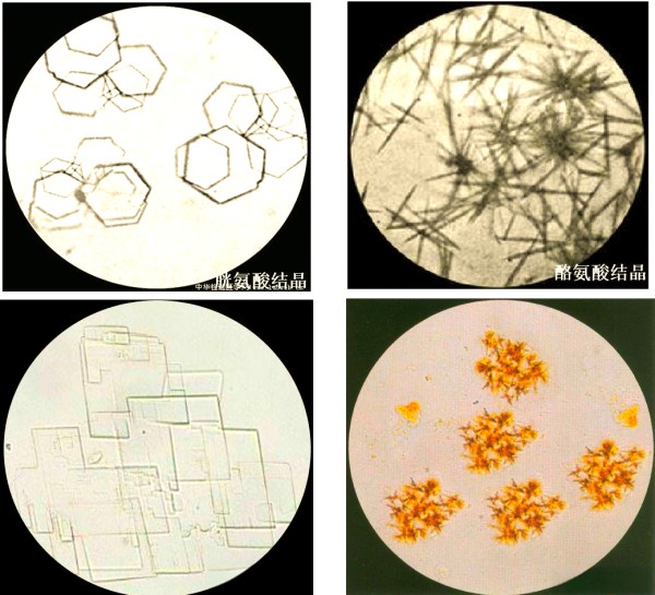 显微镜下鞣酸与蛋白质结合示意图