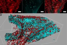 细菌爆表！这个每天用的工具真该换了，每家都有图片