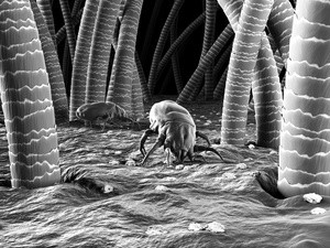 被子常年不洗容易皮肤过敏