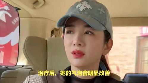 演员黄奕的嗓音治疗历程：从焦虑到改善的艰辛之路