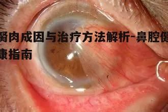 二、胬肉症状识别