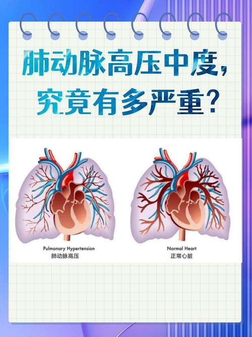 马昔腾坦_马昔腾坦用法用量_马昔腾坦片的价格