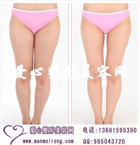 健康瘦身方法有哪些