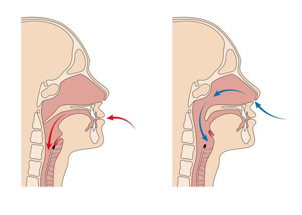 哮喘病应该注意什么