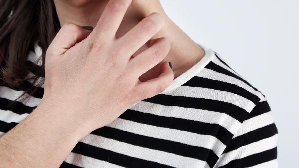 皮肤过敏红痒不能吃哪些食物