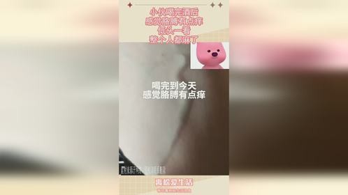 小伙喝完酒后，感觉胳膊有点痒，低头一看，整个人都麻了