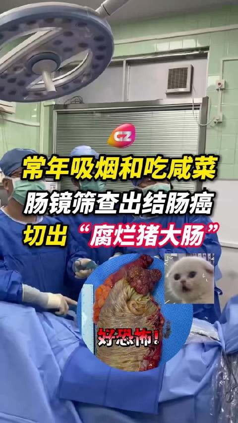 广州72岁大爷50年烟龄加长期吃咸菜确诊结肠癌，医生提醒饮食禁忌